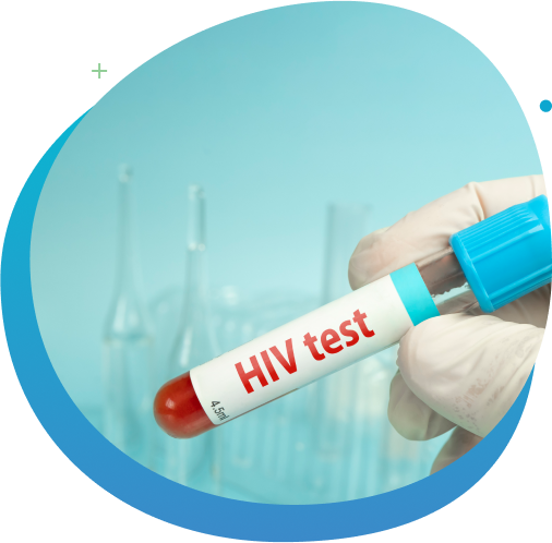 HIV test